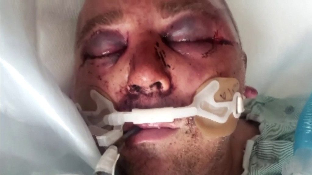 florida-man-brutally-beaten,-put-in-a-coma-after-asking-neighbors-to-lower-music