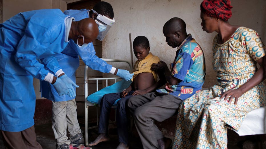 widespread-illness,-deaths-go-unnoticed-as-monkeypox-continues-to-spread-in-africa